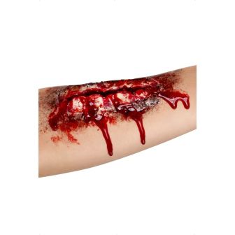 Open Wound Latex Scar